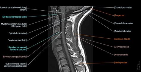 Cervical Spine Mri Normal Anatomy E Anatomy – NBKomputer