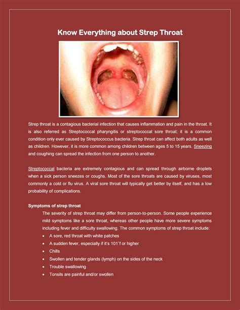 Know everything about strep throat by Health Care Tips - Issuu