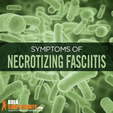 Necrotizing Fasciitis: Symptoms, Causes & Treatment