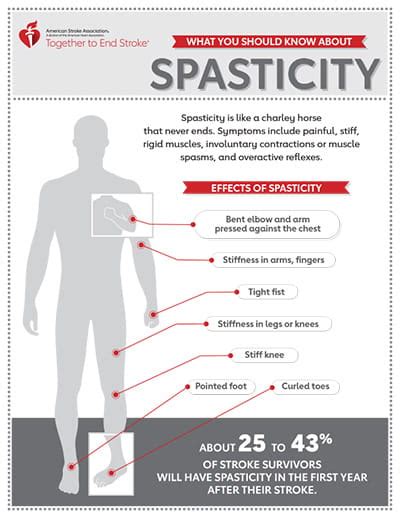 Spasticity Infographic | American Stroke Association