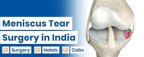 Meniscus Tear Causes, Symptoms, Tear Types and Surgeries