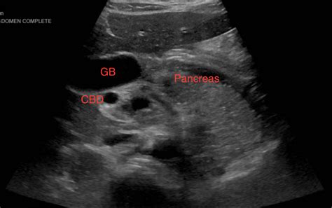 Pancreas Ultrasound