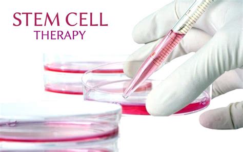 Stem Cell Therapy Shows Potential in Treating Medication-resistant ...