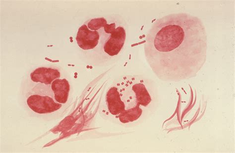 Gram Negative Cocci - Microbiology learning: The "why"ology of ...