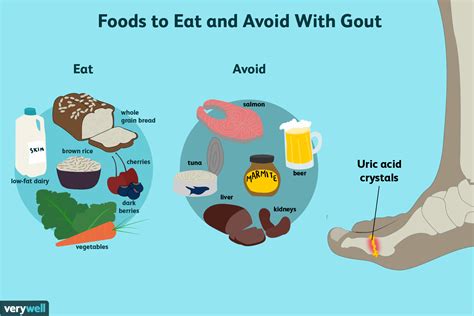 Gout Diet Foods To Avoid Spanish