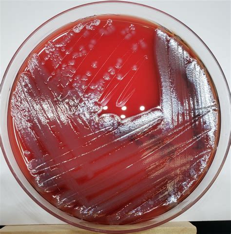 Pseudomonas aeruginosa | Pseudomonas aeruginosa growing on C… | Flickr