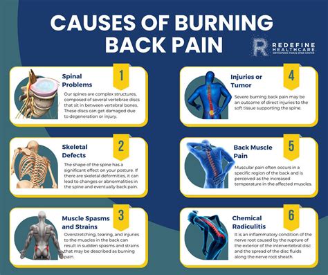 What Causes Burning Back Pain? - NJ's Top Orthopedic Spine & Pain ...