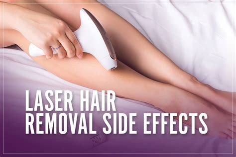 Laser hair removal side effects