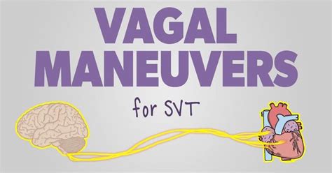 Vagal Maneuvers: How to Stop your Patient’s SVT in 2021 | Ecg rhythms ...