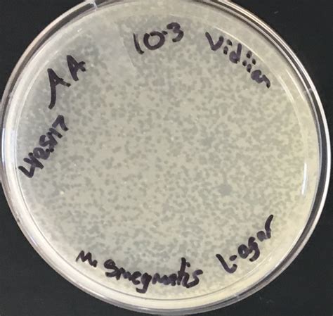 The Actinobacteriophage Database | Phage Vidiian