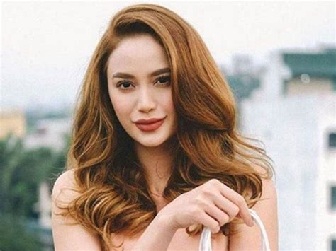 Plastic Surgeon Dr. James Joaquino Revealed Something About Arci Muñoz ...