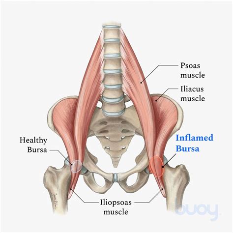 Iliopsoas Pain ⋆ Santa Barbara Deep Tissue - Riktr PRO Massage, Nicola, LMT