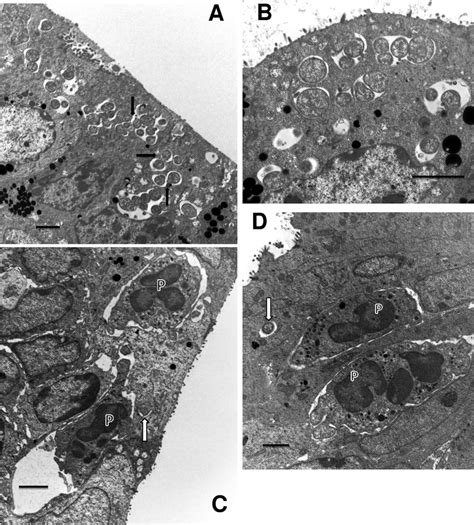 Events occurring 24 h after infection. (A) Multiple early inclusions ...