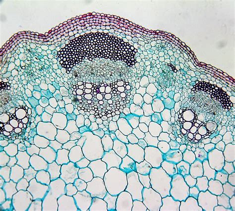 Cross section of a plant stem under a microscope. | Biology art, Plant ...