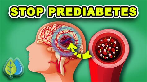 TOP 11 Prediabetes Symptoms and Treatment | How to STOP Prediabetes NOW ...