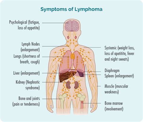 Non-Hodgkin Lymphoma (NHL) - Lymphoma Australia