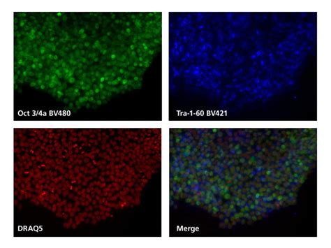 Immunofluorescence | Immunostaining | Immunocytochemistry