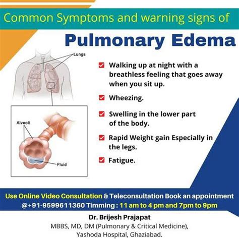 Symptoms of pulmonary edema - MEDizzy