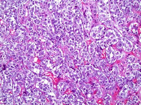 Pathology Outlines - Histology - Adrenal medulla