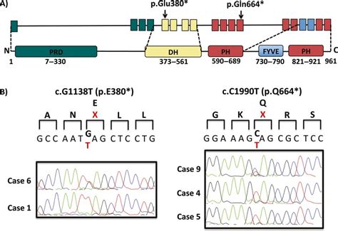 Aarskog-Scott syndrome - wikidoc