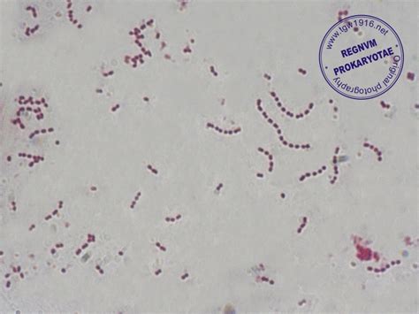 Streptococcus Pyogenes Gram Stain Reaction - slideshare