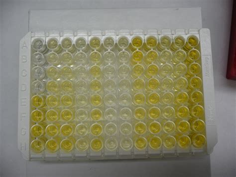 Enzyme Immunoassay Kits: How do they work? | Weinersmith