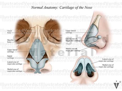 Stock Nose / Sinus: Normal Anatomy — Illustrated Verdict