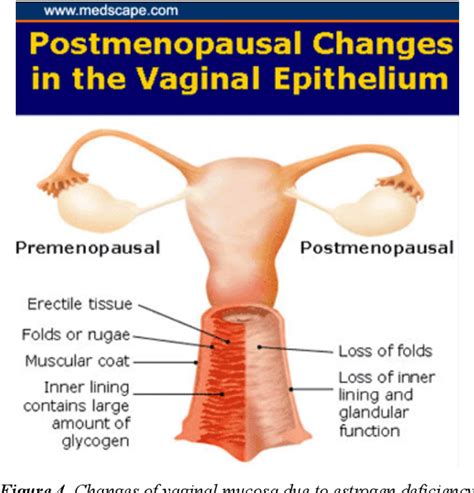 [PDF] Genito Urinary Syndrome of Menopause (GSM) or Vulvo-vaginal ...