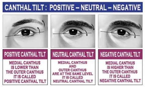 Canthal Tilt | Know Your Meme