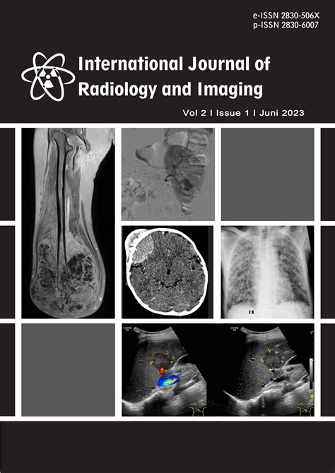 International Journal of Radiology and Imaging