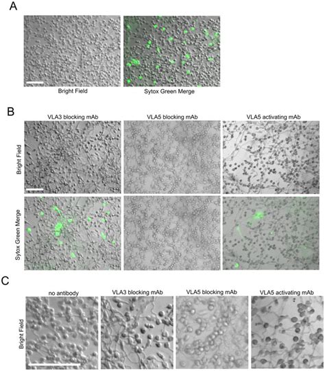 Behavior of human neutrophils in response to intact hyphae elaborated ...