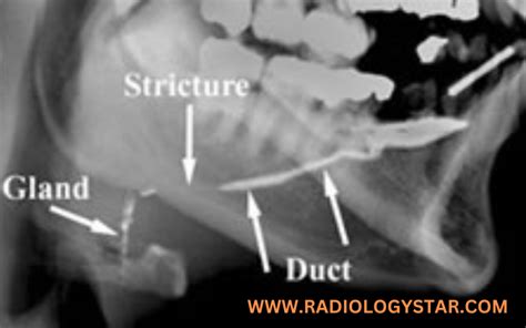 Objectives of Radiological Procedures - radiologystar