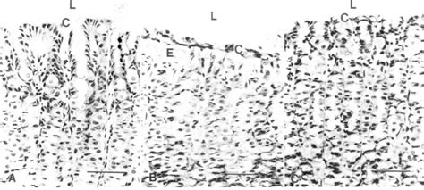 Histology of normal rat gastric foveolae and gastric foveolae showing ...