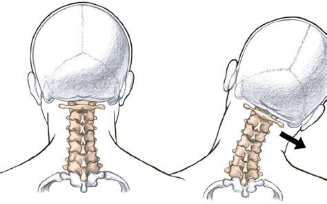 Pivot Joint Neck