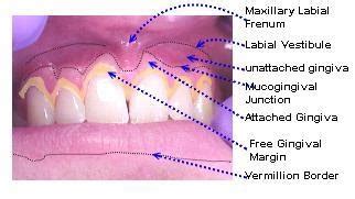 Doctors Gates: Anatomical parts of Gingiva