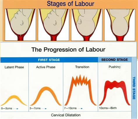 Prodromal Labor To Active Labor Phase - lidiymu