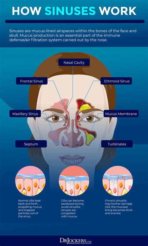 Sinus Congestion: Causes, Symptoms & Support Strategies