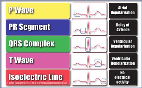 Normal Ecg Tracing