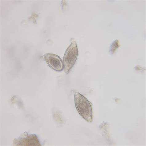 Trichuris trichiura ova whole mount, natural color, prepared microscope ...