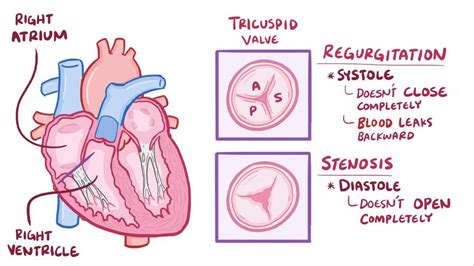 Tricuspid Valve: Overview, Function And Anatomy, 50% OFF