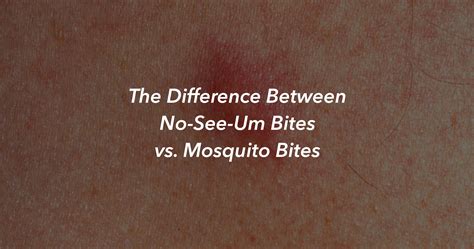 The Difference Between No-See-Um Bites vs. Mosquito Bites – The ...