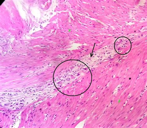 Ganglion Cells Histology