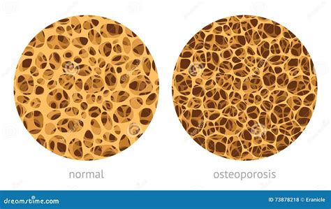 Bone spongy structure stock vector. Illustration of bones - 73878218