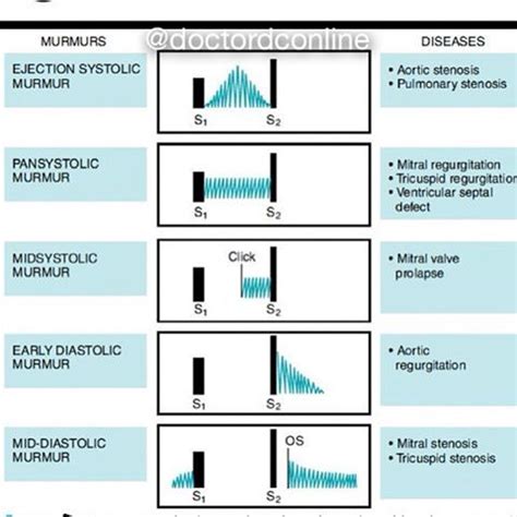 doctordconline: “ Heart Murmur A heart murmur is an extra or unusual ...