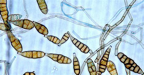 Plant rot fungus - Rekom Biotech S.L.