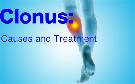 Clonus: Causes and Treatment - Rehab HQ