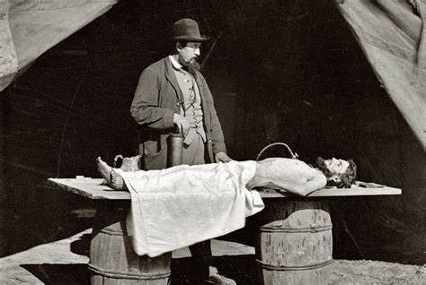 What Exactly is Embalming?