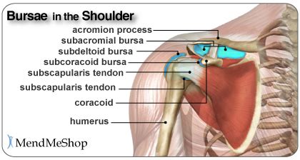 Shoulder Bursitis