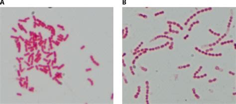 Coccobacilli (Gram Negative Bacteria) - Laboratoryinfo.com