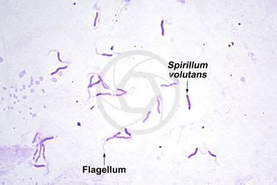 Spirillum volutans - Spirillum - Bacteria - Aquatic life - Photos